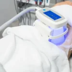Cryolipolyse - sculpter votre silhouette sans chirurgie
