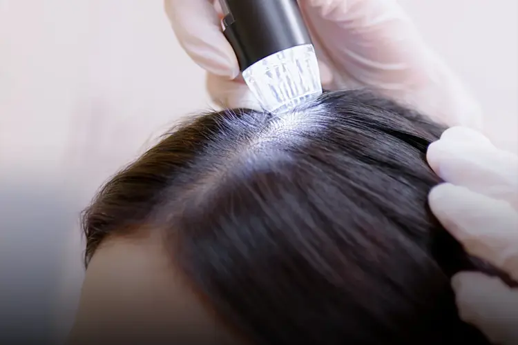 Soins capillaires : conseils d’un médecin pour des cheveux brillants - consultation en cabinet esthétique avec diagnostic capillaire
