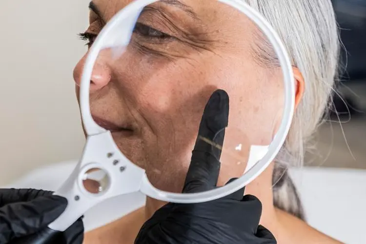 Taches pigmentaires : causes, prévention et traitements - un traitement laser en cabinet esthétique